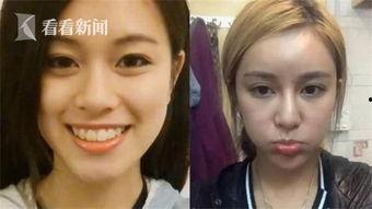 整容女视频,美丽背后的代价