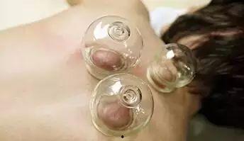 拔火罐视频大全,揭秘传统养生秘技